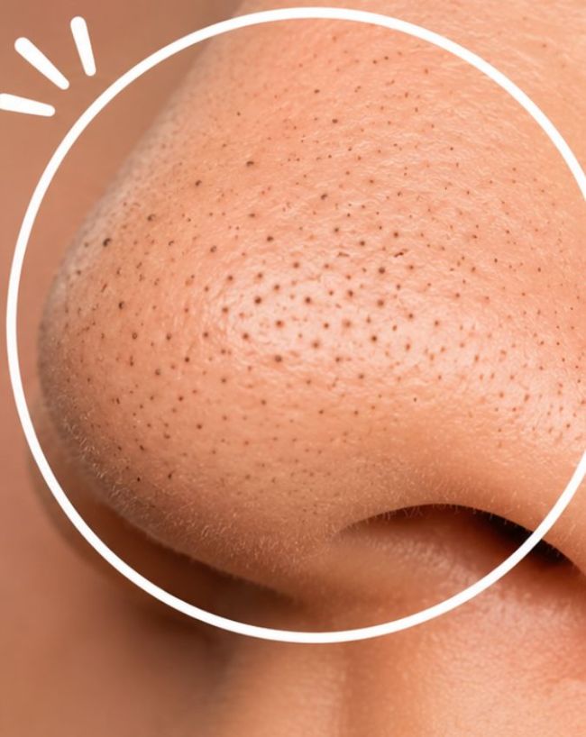 सेलिसिलिक एसिड क्लेंजर 