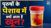 Peshab me khoon aana