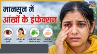 Monsoon Eye Infection