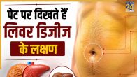 liver disease