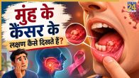 mouth cancer Symptoms