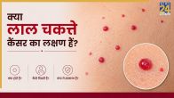 Red Spots Cancer Symptoms