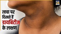 Early Signs Of Diabetes