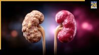 symptoms of kidney failure in 5 stages
