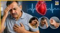 bradycardia ecg