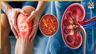 uric acid food to avoid