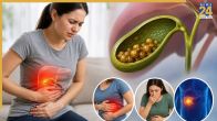 Gallbladder Stone Symptoms
