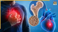 Calcium Deficiency and Heart Problem