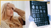 Brain Cancer Early Symptoms Vs Stress