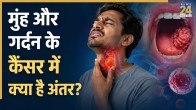 HPV Or Tobacco Linked Cancer