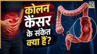 Colon Cancer Symptoms