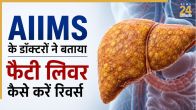 Fatty Liver Symptoms