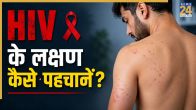 HIV Symptoms In Men