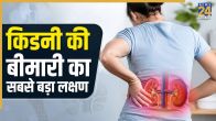 Kidney Disease Ke Lakshan