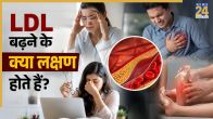 Bad Cholesterol Signs On Body