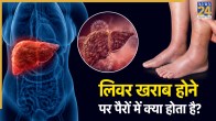 liver disease symptoms