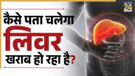 Liver disease symptoms