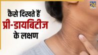 Pre Diabetes Symptoms