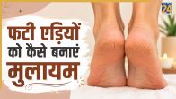Cracked Heels Home Remedies