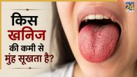 Dry Mouth Causes