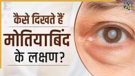 Motiyabind Symptoms
