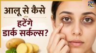 potato juice for dark circles