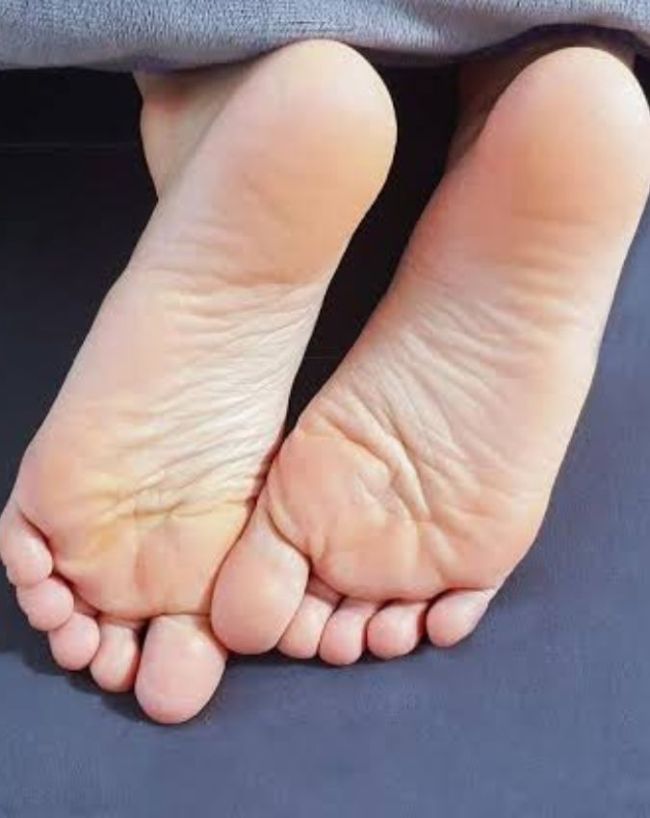 डायबिटीज में पैरों की समस्या क्यों होती है?