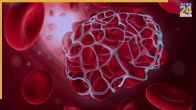 Signs of thick blood