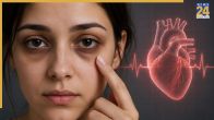 Dark Circles Relation Is Heart