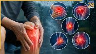 Joint Pain Problem