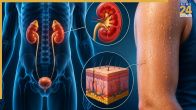 Is The Skin The Third Kidney
