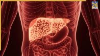 Foods for Fatty Liver