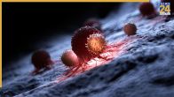 Cancer Lump Disease