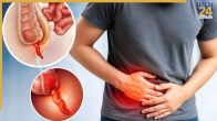 Appendix Pain Causes